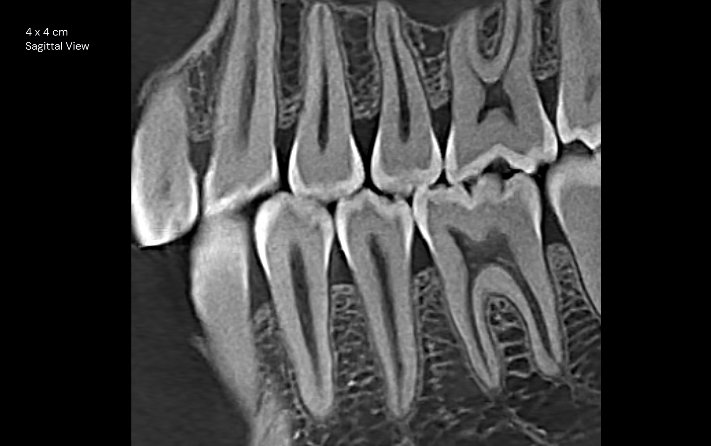 4 x 4 cm Sagittal View